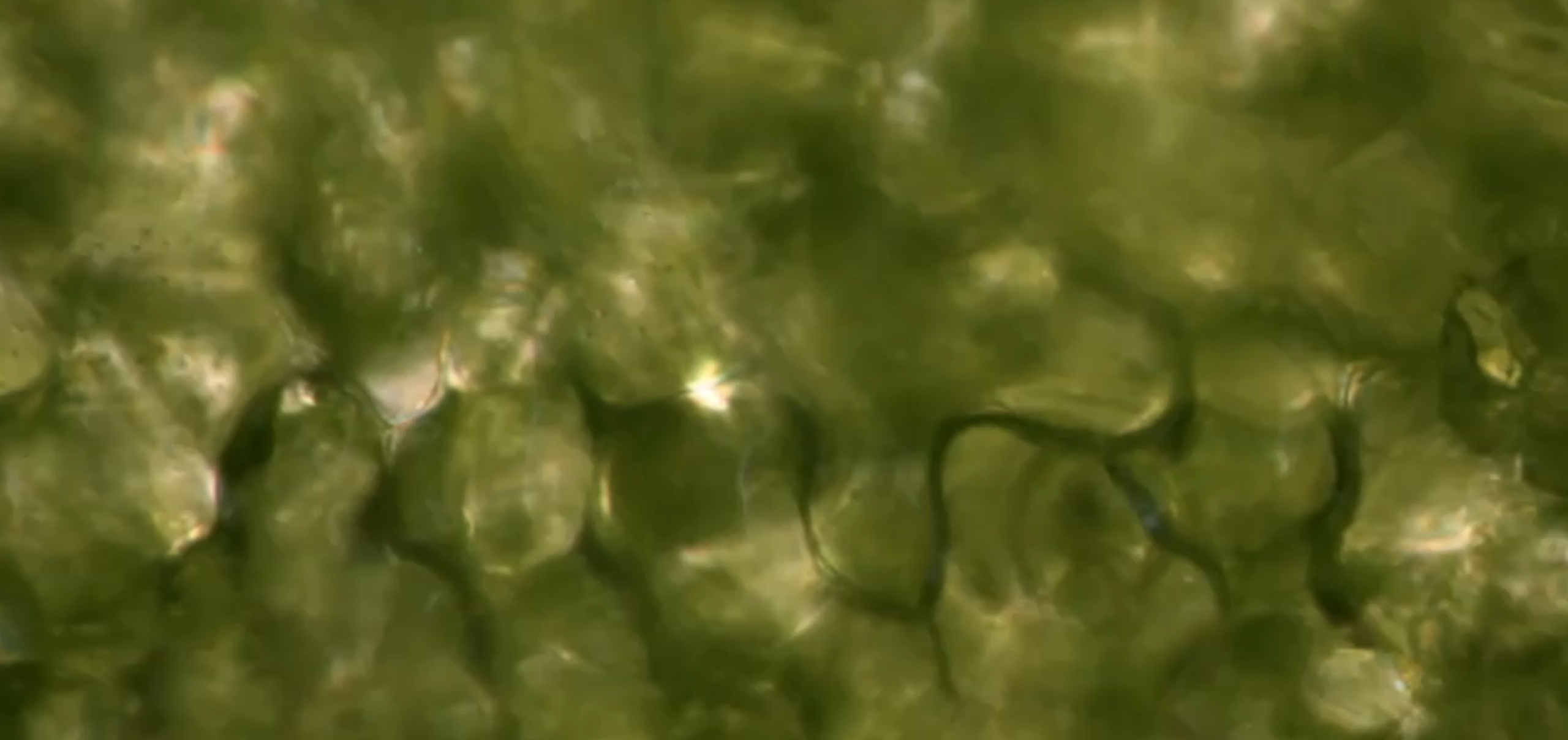 What is Leaky Gut? Understanding Intestinal Permeability
