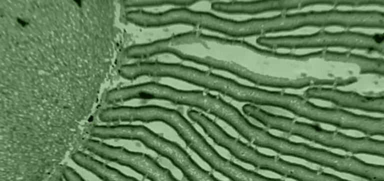 Probiotics for Liver Health: A Science-Backed Guide