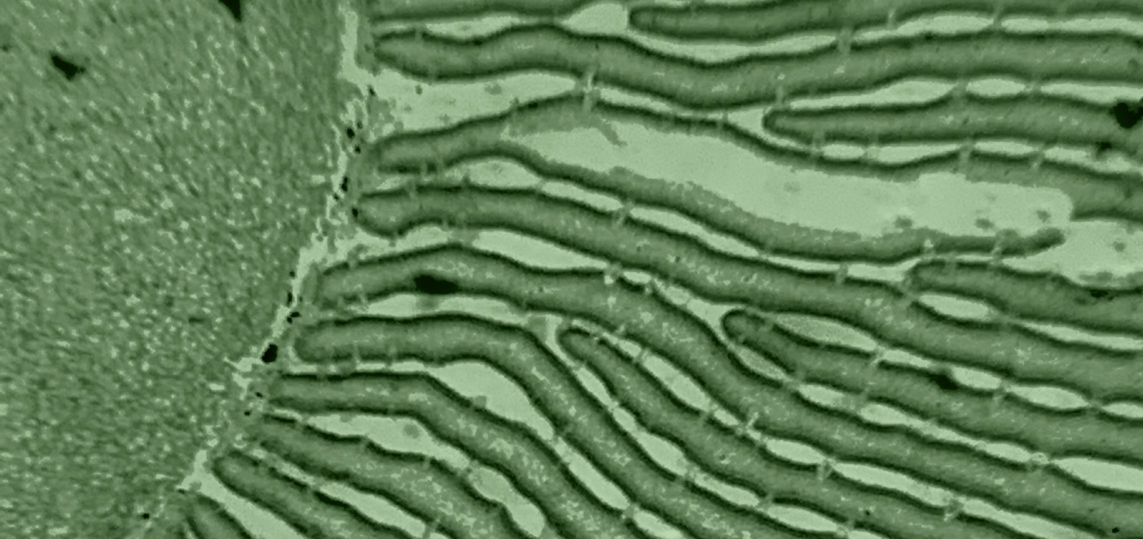 Probiotics for Liver Health: A Science-Backed Guide