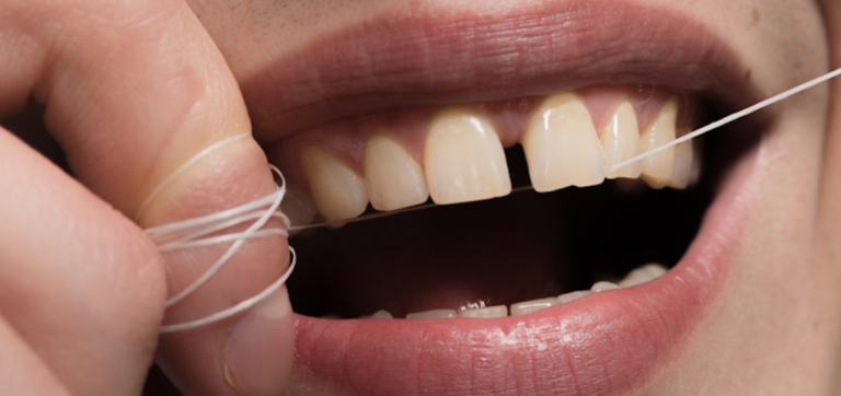 Probiotics for Bad Breath: Science-Backed Solution or Oral Health Hype?